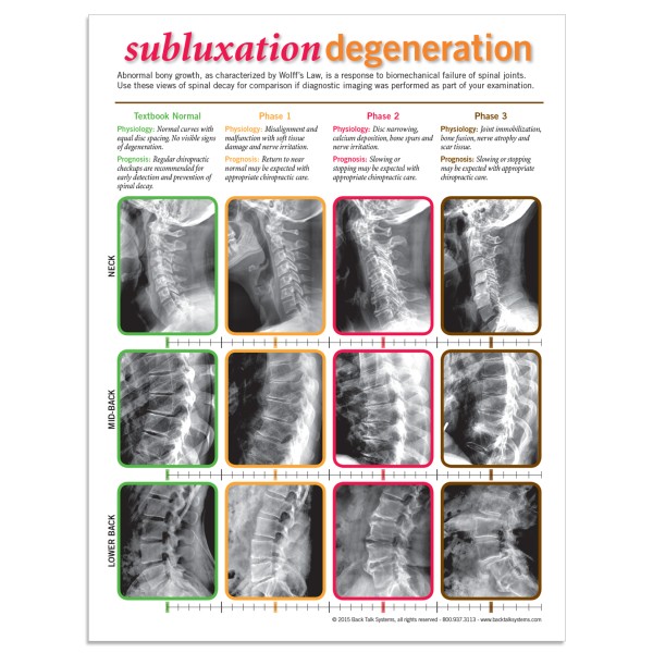 Handouts - Subluxation Degeneration
