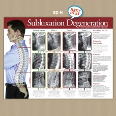 Poster - Subluxation Degeneration